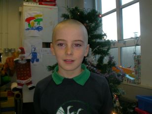 Sean O\'Reilly shaved his hair for Cancer Research.